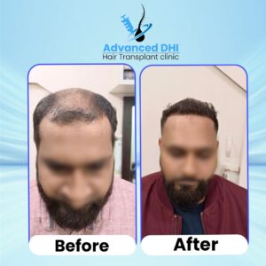 Hair2